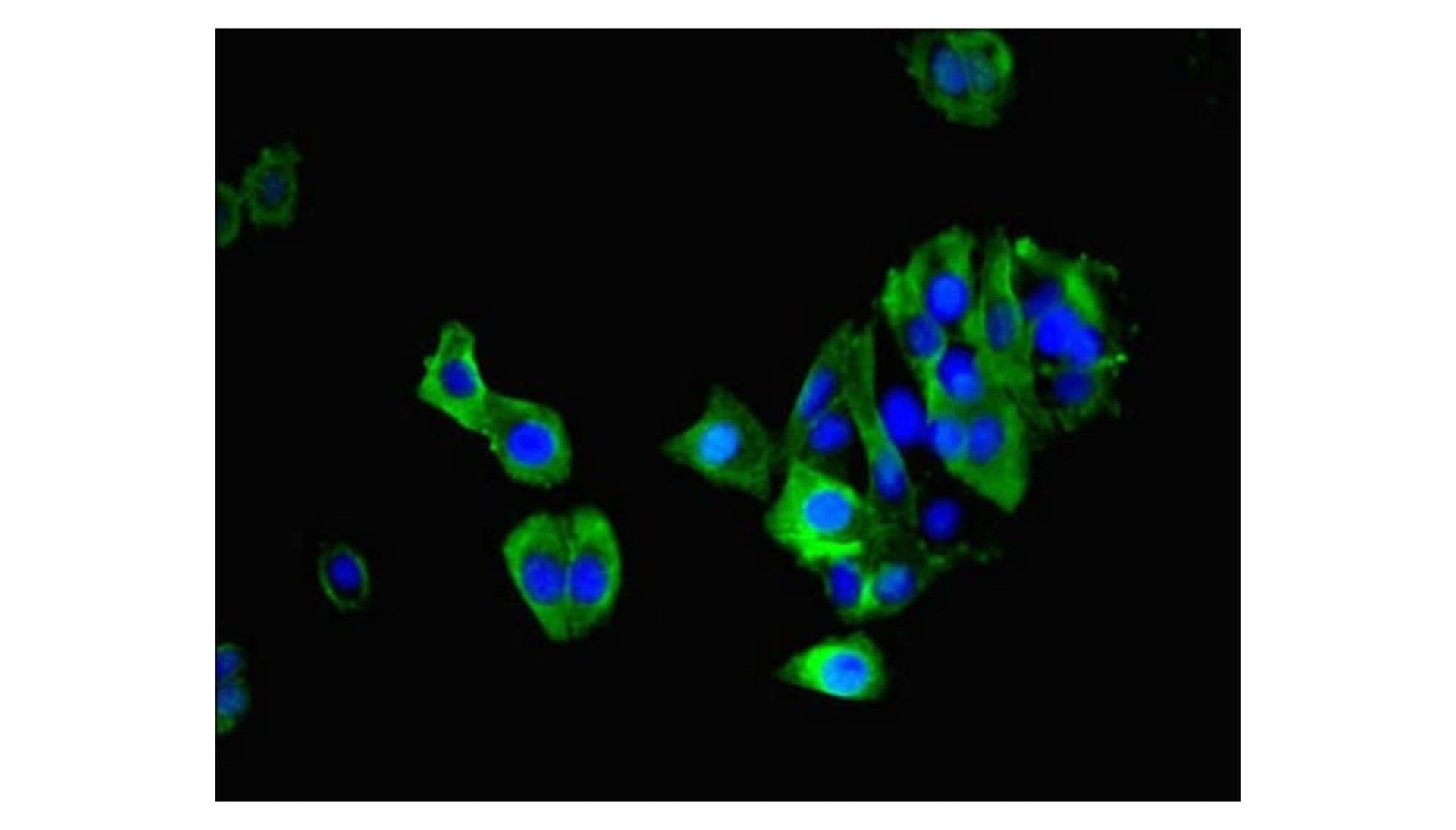 MAS1 receptor (MAS-R) autoantibody